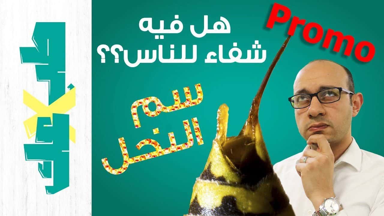 لسع النحل - فيه شفاء للناس!!