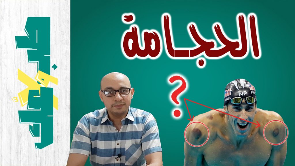 الحجامة طب ولا عك؟