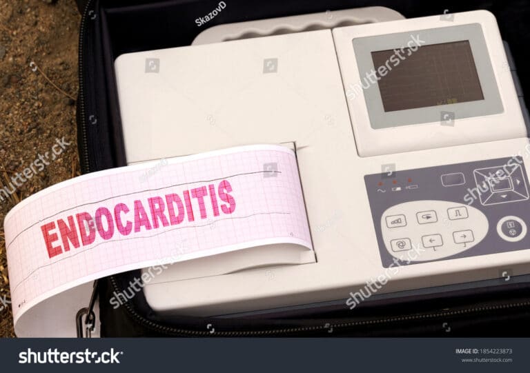 Endocarditis  التهاب الشغاف