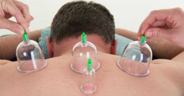 تفصيل الكلام في الحجامة - ما هي أحاديث الحجامة الضعيفة والصحيحة؟ - الطب النبوي الحقيقة والإدعاء