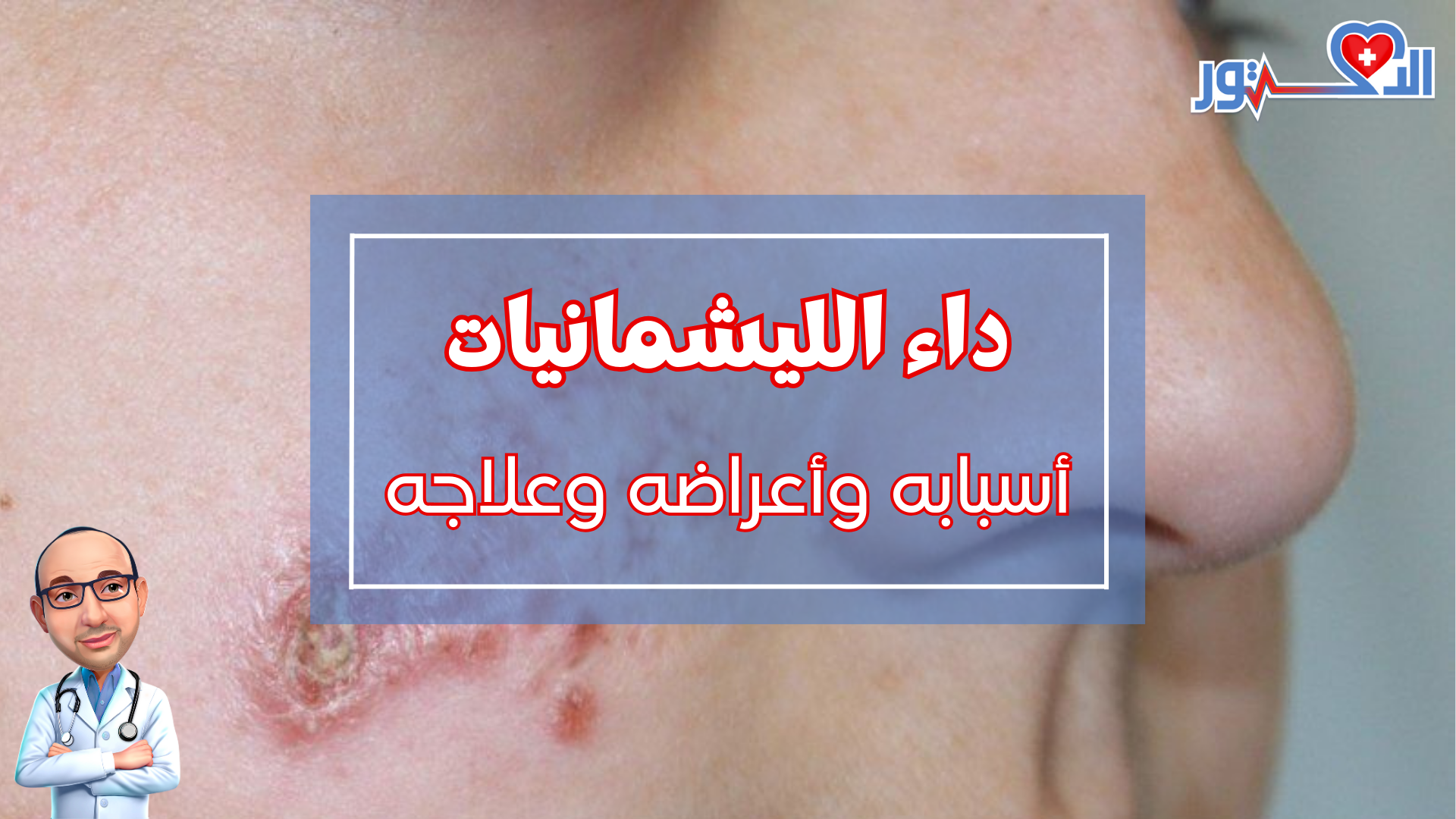 داء الليشمانيات اسبابه واعراضه وعلاجه