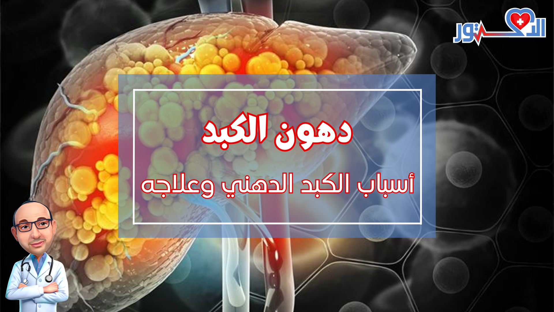 دهون الكبد - اسباب الكبد الدهني وعلاجه